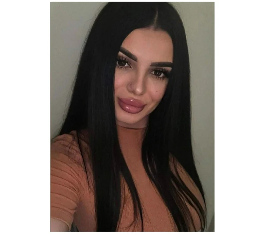 Escort Gallery