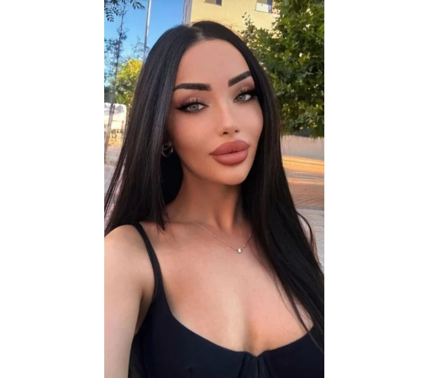 Escort Gallery