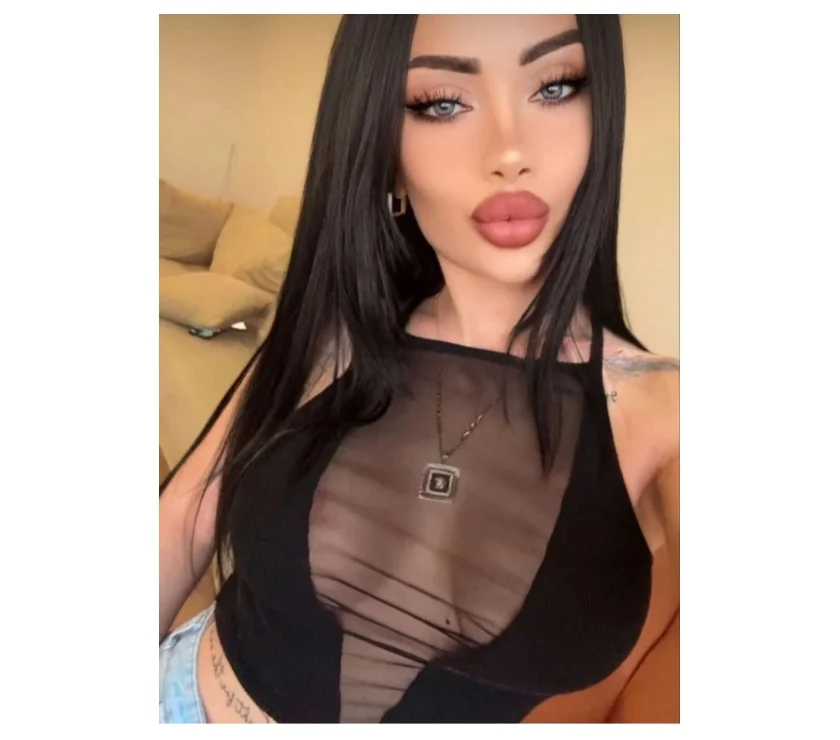 Escort Gallery