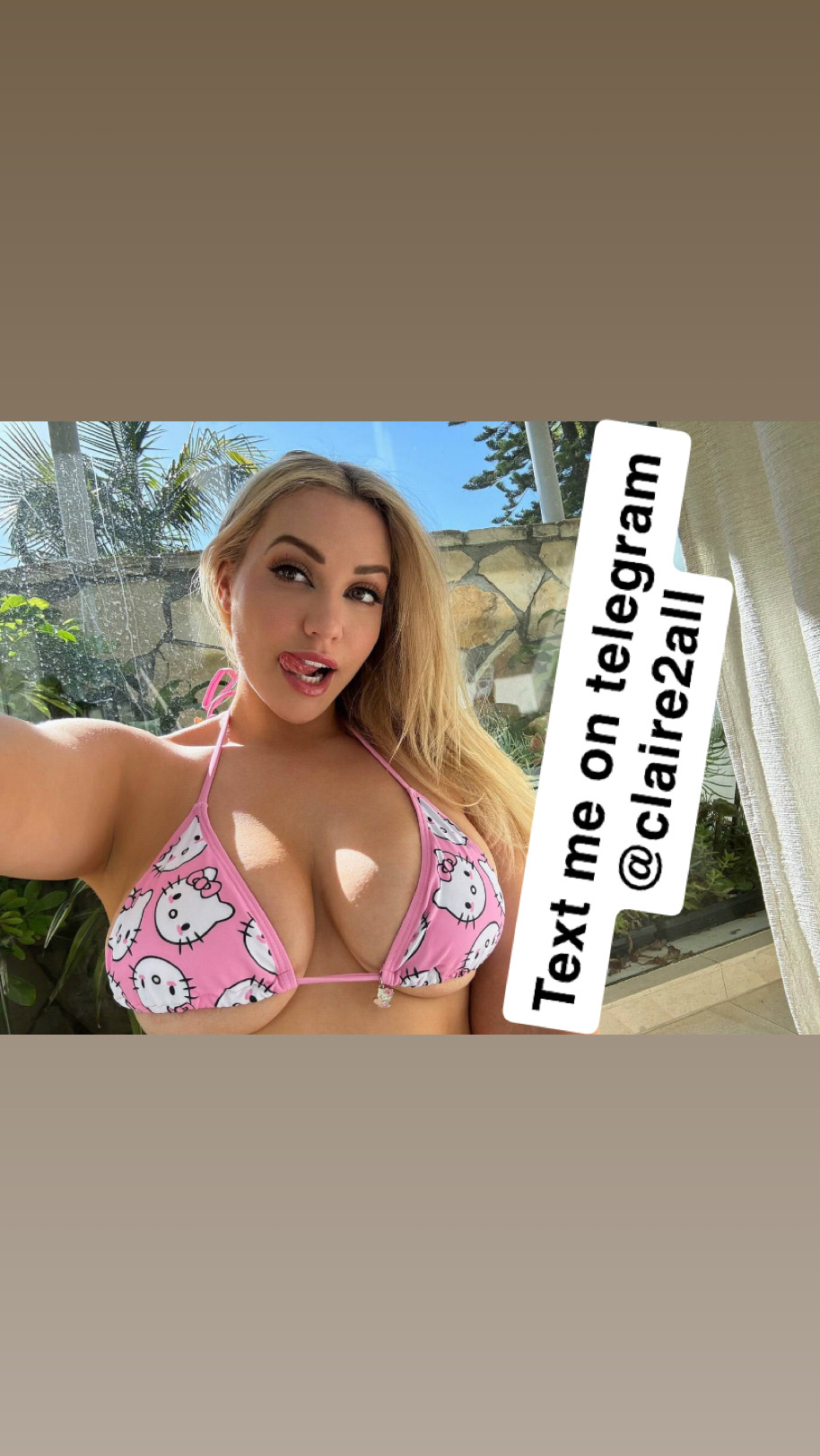 Escort Gallery